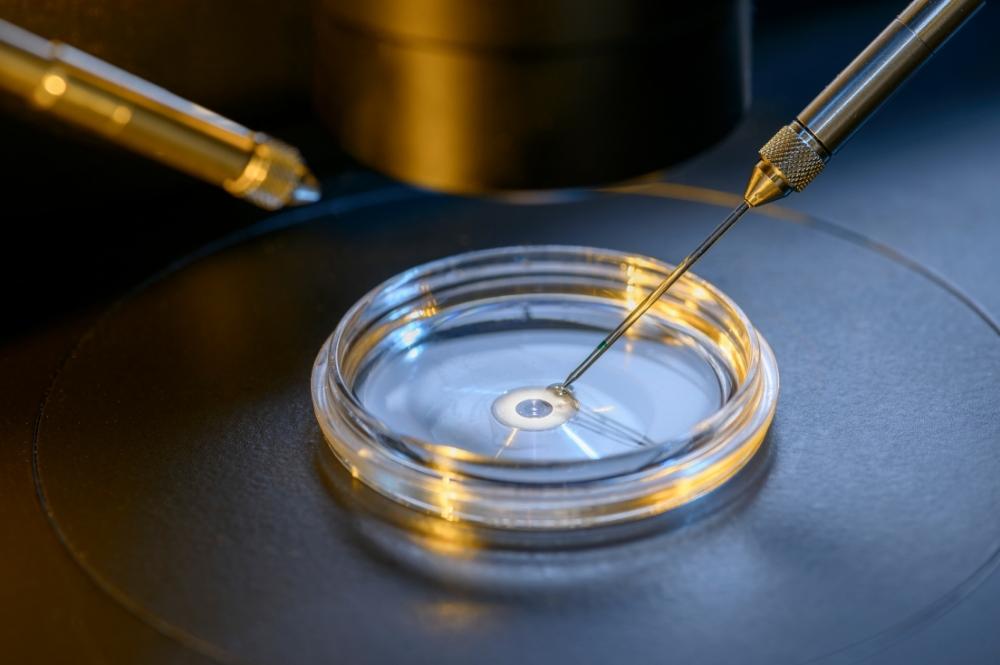Yumurta Toplama İşlemi  (Oocyte Pick Up= OPU)